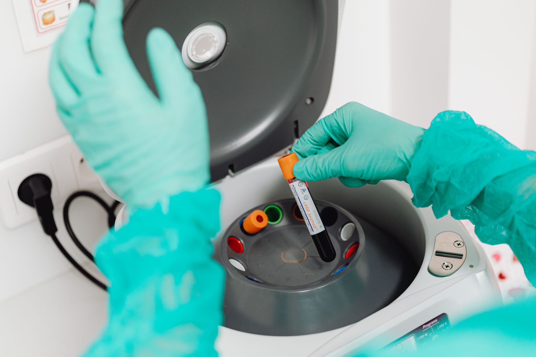 Laboratorio realizando coleta para exame toxicologico admissional e demissional